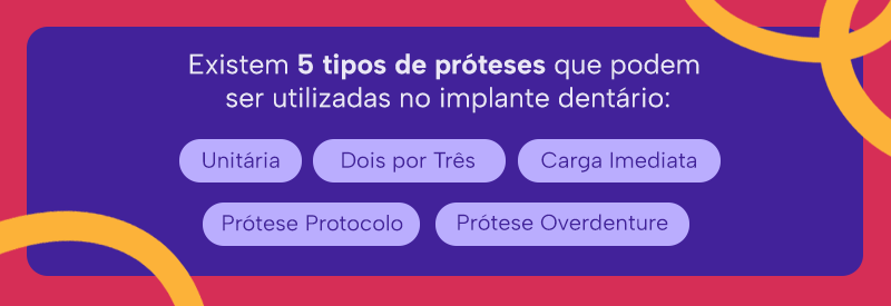 Existem 5 tipos de próteses que podem ser utilizadas no implante dentário:
Unitária

Dois por Três
Carga Imediata
Prótese Protocolo
Prótese Overdenture
